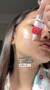 【จัดส่งวันนี้】เจลลดรอยมานูก้า Manuka Dark Spot Intensive Gel ฟาวเดอร์สกิน ขนาด 18 กรัม