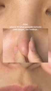 FOCALSKIN 3 Step Removes Blackhead Nose Patch Masker Komedo Stiker Jerawat Anti Acne Pencabut Komedo Shrink Pore and Soothing Skincare