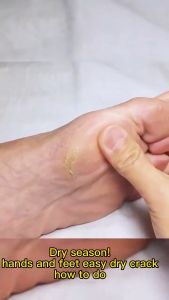 Horse Oil Hand & Foot Cream: Anti-Chafing Skin Repairing Moisturizer