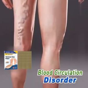 15pcs Varicose Veins Herbal Healing Patch Koyo Varises Herbal