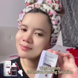 peeling solution Whitening salicylic acid aha bha pha dark spot serum Brightening Acne Prone 30ml
