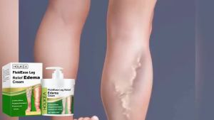 Leg Edema Relief Cream Remove Leg Swelling Repair Varicose Veins Antiedematous Foot Improves Circulation Anti Edema Ointment