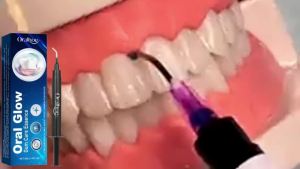 EELHOE | Gum Repair Care Gel Relieve Sore Gum Improve Gingival Damaged Inflammation Cleaning Teeth Stains Tartar Whitener Gum Protect Gel