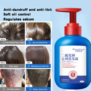 Oil Control Dandruff Treatment Shampoo 300ml Selenium Sulfide Scalp Health Scalp Treatment Oil Control Reduces Flaking Itching