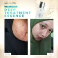 deep treatment essense DTE msglow original. 