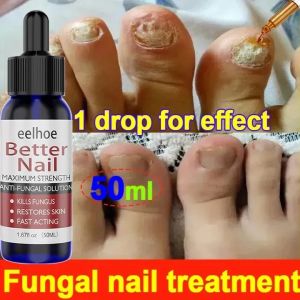 Obat Jamur Kuku Paling Ampuh Nail Repair Essence Serum Ajaib Viral Di Mengobati Kuku Berjamur Dan Rusak 50ml