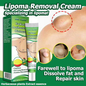 Authentic Lipoma Removal Cream Original Lipoma Cream Original Quickly Eliminate Fat Lump Tendon Sheath Cyst Subcutaneous Cyst and Fat Granule Lipoma Cream 20g