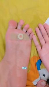 Wart Remover Pads/Corn Remover Wart And Skin Tag Removal Mole Corn Caps Medicated Plasters 鸡眼贴 12pcs/box