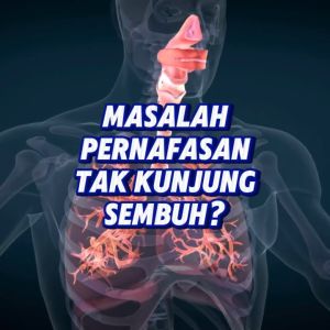 Etawaku Platinum - Susu Kambing Etawa Pembersih Paru Paru Atasi Masalah Pernafasan Asma Sesak Nafas