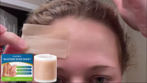 Laniska Silicone Scar Sheet – Breathable & Waterproof Scar Patch Improves & Lightens Scars Cut to Any Size Soft & Gentle on Skin 4cm x 150cm