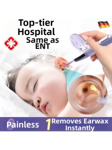 MENGYUXI | Lighted Earwax Removal Tool for Children