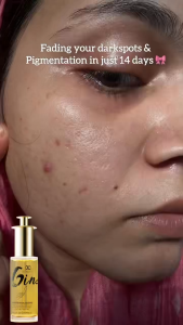 Ginseng Serum Collagen Essence Serum Pemutih Serum Penghilang flek hitam Pemutih permanen Mencerahkan Kulit Anti-kerut dan anti penuaan Melembab kulit Memperbaiki Kulit Kusam 30ml