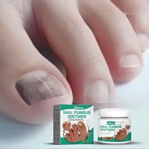 High Quality 【 Spot inventory 】South Moon Grey Nail Cream Thickened Bright Nail Grey Nail Repair Soft Nail Cream Hand and Foot Rotten Toe Care  Nail Fungus Treatment Cream Fast Recovery Onychomycosis Paronychia Anti Infection Toe Fungal Rem