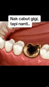 SOPAMI SP7 Pasta Gigi Pemutih Cepat Hilangkan Noda Kuning & Plak Perlindungan 7x Lebih Lama