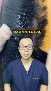 Dầu gội hỗ trợ giảm gàu nấm ngứa Santal 300 shampoo bản Tuýp - Biocarepharma.