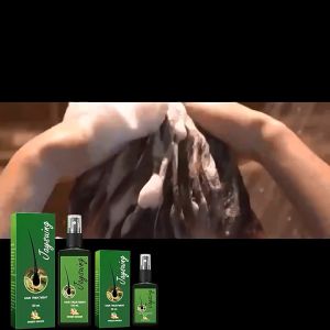 Hair Tonic Rambut Perontok Serum Penumbuh Rambut Cepat Dan Tebal Obat Penumbuh Rambut Botak Hair Growth Serum Menutrisi Secara Mendalam