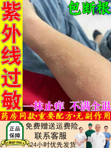 Hormone-Free UV Allergy Treatment Topical Repair Cream Soothing Moisturizer for Sunburned Skin Relieves Neurodermatitis