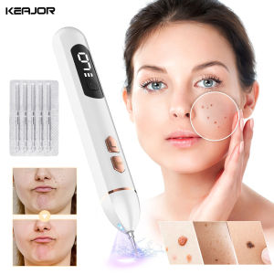 Skin Tag Remover Face Freckle Black Dots Blemish Removal Papillomas Mole Nevus Remover Electric Laser Plasma Pen Wart Eliminator