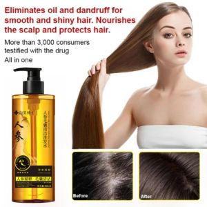 Ginseng Follicle Cleansing Shampoo Anti-Dandruff Anti-Itching Refreshing Shampoo Oil Control Plant Extract Essence