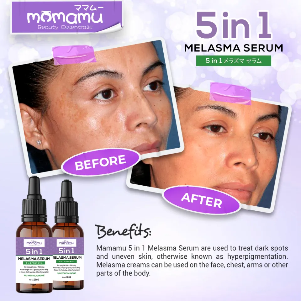 Melasma Serum by Mamamu 20 mL Effective Melanin Reducer Pekas