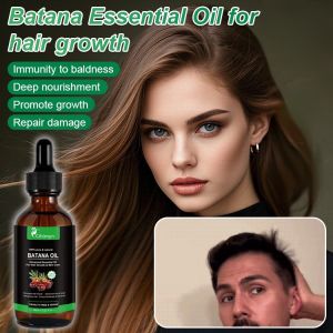 ✨Quick Results✨【Promote Hair Growth/Reduce Hair Loss】巴塔纳精油促进头发生长精华Batana Essential Oil For Hair Growth/Batana Oil100%Pure&Natural Hair Growth Serum/Natural Vitamins Hair Care Essence/Hair Growth Treatment