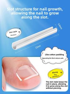 Ingrown Toenail Correction Tool Ingrown Toenail Patches plys
