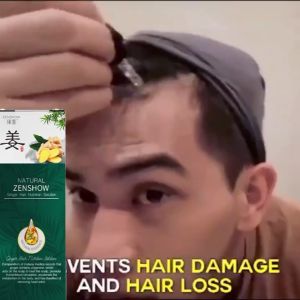 obat ampuh untuk rambut perontok parah-penumbuh rambut secara cepat-obat penumbuh rambut botak-hair tonic penumbuh rambut-penumbuh rambut botak pria-penumbuh rambut botak wanita-Serum Anti Botak Rambut-penumbuh rambut cepat dan tebal-Pencegah Rambut Ronto