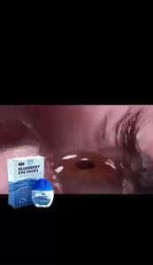 Blueberry Eye Drops: A Comprehensive Guide to Eye Health