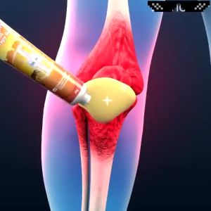 Soothing Bee Venom Analgesic Cream Zealand Bee Venom Professional Gel Pain Relief Ointment for Arthritis Knee Joint Muscle Massage