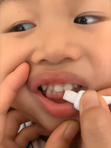 3pcs - Nano Dental Cleaner - Teeth Whitening & Plaque Removal Tool for Adults & Children - Yellowing & Tooth Dirt Cleaner - Ship out within 2days