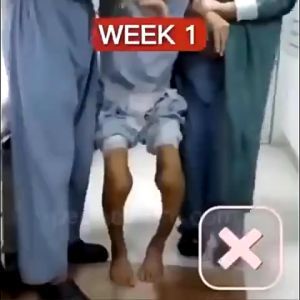 Gel Bôi Xương Khớp Nọc Ong Giảm Đau Khớp/đau cổ