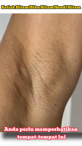 Krim Pemutih Vitamin C 50g Pemutih Tubuh Melanin Ketiak Sensitif Siku Lutut Leher Krim Ketiak Pemutih Ketiak