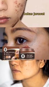 100g Krim Pemutih Flek & Penghilang Flek Hitam di Wajah