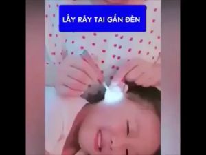 Bộ lấy ráy tái có đèn cao cấp đầu silicon soi tai trẻ em an toàn dễ dàng không gây đau rát tai cho bé Gia dụng Phước Hòa