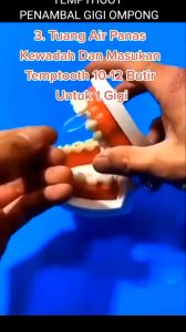 Sws Temptooth 100 Butir Penambal Gigi Berlubang