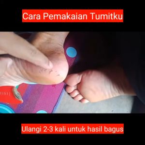 Tumitku 30ml BPOM  Obat Kaki Pecah Ampuh Mengatasi Kapalan dan Menghaluskan Tumit Kaki Pecah