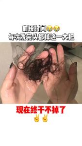 Lược Massage Kích Thích Mọc Tóc Công Nghệ Tiên Tiến SPA Super Hair EMS TECHNOLOGY 🔰Phụ Kiện Thuận Lợi🔰