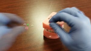 Combo 4 Cây móc thun liên hàm - Cây móc thun chỉnh nha - Dụng cụ hỗ trợ móc thun liên hàm chỉnh nha