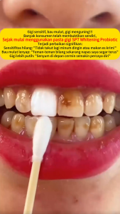 SP-7 Pemutih Gigi Dan Karang Gigi Rrobiotic Whitening Toothpaste -Perawatan Mulut Menyegarkan Untuk Gigi Bersih 100g Whitening SP7 Memutihkan Gigi