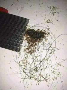 Obat Ampuh Kutu rambut anak anak Pembersih Telor Kutu Minyak Rambut Pembasmi Kutu Herbal original Bpom