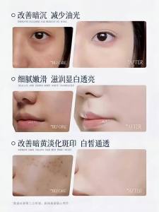 CKCU | Whitening Amino Acid Cleanser Oil-control Deep Clean Fade Spots Shrink Pores
