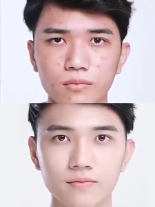 Mens facial cleansing milk acne removal facial cleanser quickly cleanses the face removes acne lightens acne scars controls oil improves pore blockage 150g