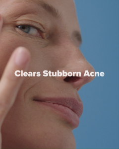 Paulas Choice Clear Extra Strength Anti-Redness Exfoliating Solution 2% BHA (Salicylic Acid) - Unclogs Pores & Reduces Blackheads