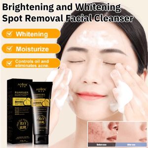 Whitening Spot Removal Facial Cleanser Deep Clean Oil Control Remover Melasma Spot Pigment Melanin Face Wash