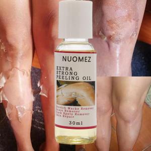 30/110ML Body Care Exfoliating สีเหลือง Peeling Oil 100% Organic Bleaching Dark Skin Serum Dark Knuckles Fast Whitening เครื่องสําอาง