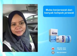 UBAT PUTIH GLUTAB GLUTATHIONE PLUS SOLUSI JAGA JERAWAT supplement Vitamin C Glow Skin Whitening membantu merawat kulit kusam jaragat 美白 collagen Kulit Putih Cerah Glowing Original malaysia "5 capsule"