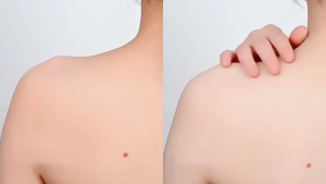 Vitamin C Whitening Soap LYDIMOON Private Parts Whitening Lighten Melanin Exfoliating/Chicken Skin Removal/Acne Removal/Deep Skin Care 100g