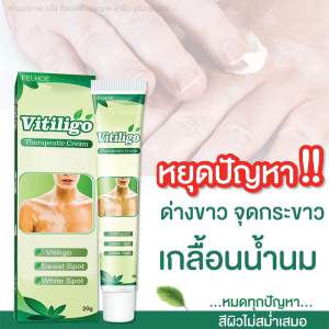 Vitiligo ขนาด 20 กรัม ด่างขาว ปรับสีผิวให้สม่ำเสมอ ของแท้💯% ( 10 หลอด)