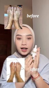 D'SAVIOR Body Oil 30ml | Penghilang Bekas Luka Eksim Psioriasis Stretchmark dan Gatal Alergi