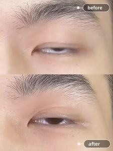 LuckFavor | Băng Dán Nắp Thượng Mắt Không Nhìn Thấy Thiên Nhiên Chống Nước Chống Mồ Hôi Cho Mắt Sưng